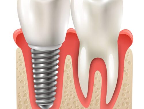 СПАС: Современная стоматология в Москве СПАС: Современная стоматология в Москве